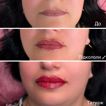 Спочатку підкололи губи 💉💋 1 мл. А потім зробили татуаж. Колір rose red 🌹