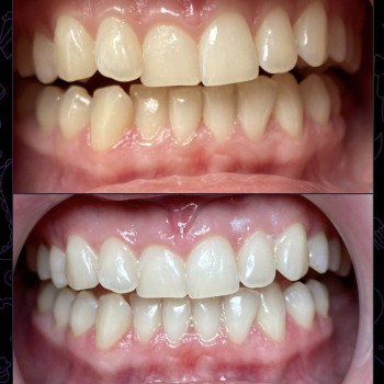 Фото с портфолио Smile Bar