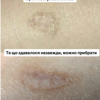 Фото с портфолио Алена 