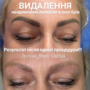 Фото с портфолио Инна Ткач