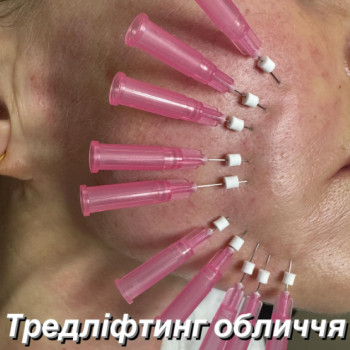 Фото с портфолио Елена Мазур