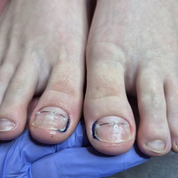 Фото с портфолио OH NAILS