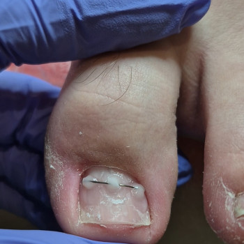 Фото с портфолио OH NAILS