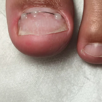 Фото с портфолио OH NAILS