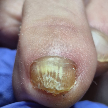 Фото с портфолио OH NAILS