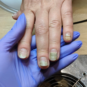 Фото с портфолио OH NAILS