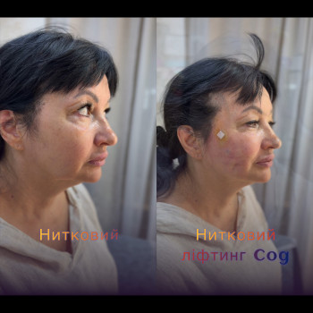 Фото с портфолио Любов Чумаченко