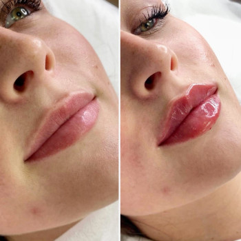 Фото с портфолио Healthy & beauty club