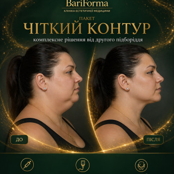Фото с портфолио Bariforma