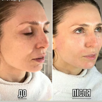 Фото с портфолио Сфера Плюс