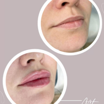 Фото с портфолио Healthy & beauty club