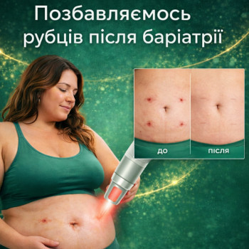 Фото с портфолио Bariforma