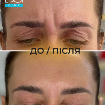 Фото с портфолио Dr. Galatska clinic
