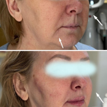 Фото с портфолио Dr. Galatska clinic