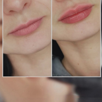 Фото с портфолио Dr. Galatska clinic