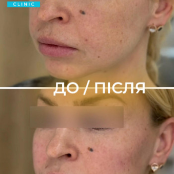 Фото с портфолио Dr. Galatska clinic