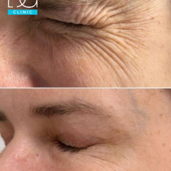 Фото с портфолио Dr. Galatska clinic