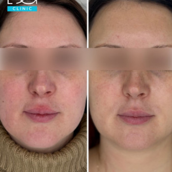 Фото с портфолио Dr. Galatska clinic