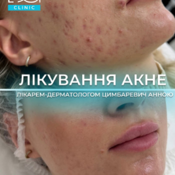 Фото с портфолио Dr. Galatska clinic