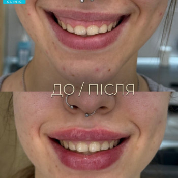 Фото с портфолио Dr. Galatska clinic