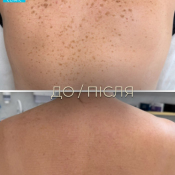 Фото с портфолио Dr. Galatska clinic