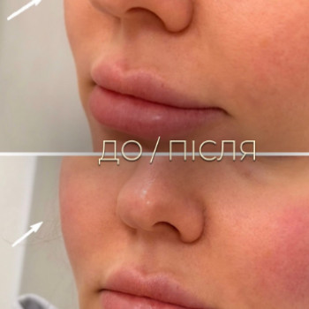 Фото с портфолио Dr. Galatska clinic