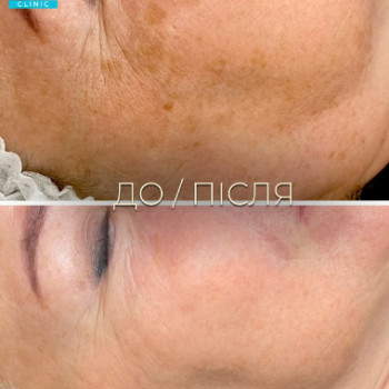 Фото с портфолио Dr. Galatska clinic