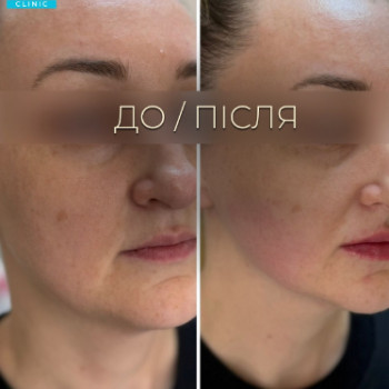 Фото с портфолио Dr. Galatska clinic