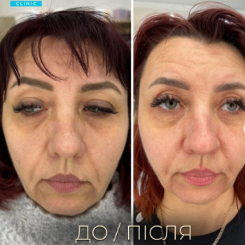 Фото с портфолио Dr. Galatska clinic