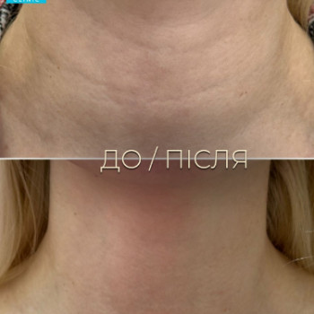 Фото с портфолио Dr. Galatska clinic