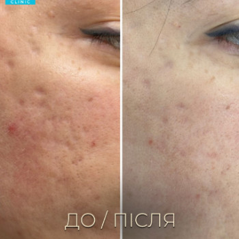 Фото с портфолио Dr. Galatska clinic