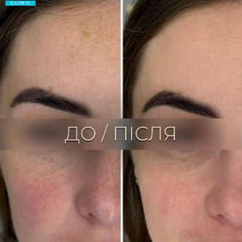 Фото с портфолио Dr. Galatska clinic