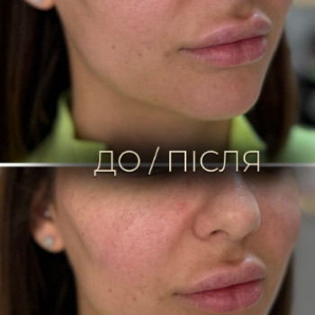 Фото с портфолио Dr. Galatska clinic
