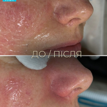 Фото с портфолио Dr. Galatska clinic
