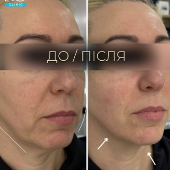 Фото с портфолио Dr. Galatska clinic