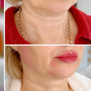 Фото с портфолио Dr. Galatska clinic
