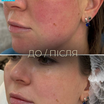Фото с портфолио Dr. Galatska clinic