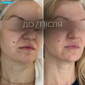 Фото с портфолио Dr. Galatska clinic