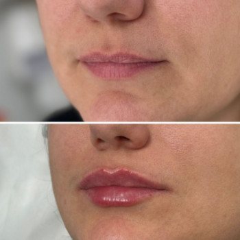 Фото с портфолио Dr. Galatska clinic