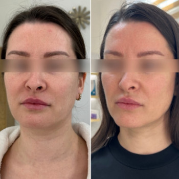 Фото с портфолио Dr. Galatska clinic