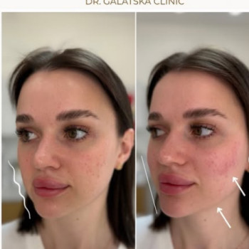 Фото с портфолио Dr. Galatska clinic