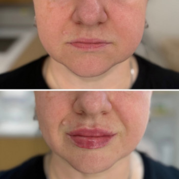 Фото с портфолио Dr. Galatska clinic