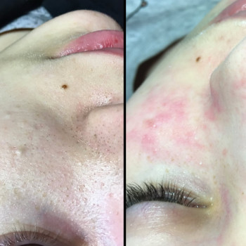 Фото с портфолио Perfect Skin