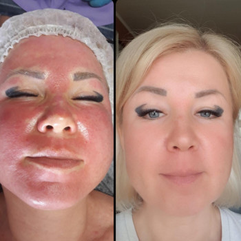 Фото с портфолио Perfect Skin