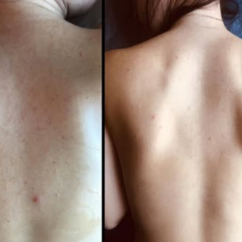 Фото с портфолио Perfect Skin