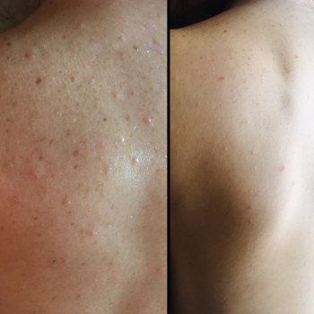 Фото с портфолио Perfect Skin