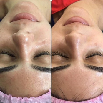 Фото с портфолио Perfect Skin
