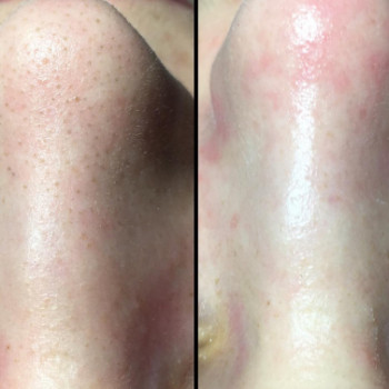 Фото с портфолио Perfect Skin