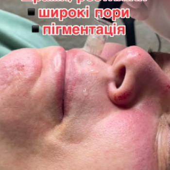 Фото с портфолио Perfect Skin
