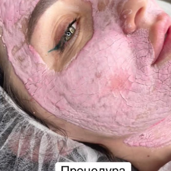 Фото с портфолио Perfect Skin